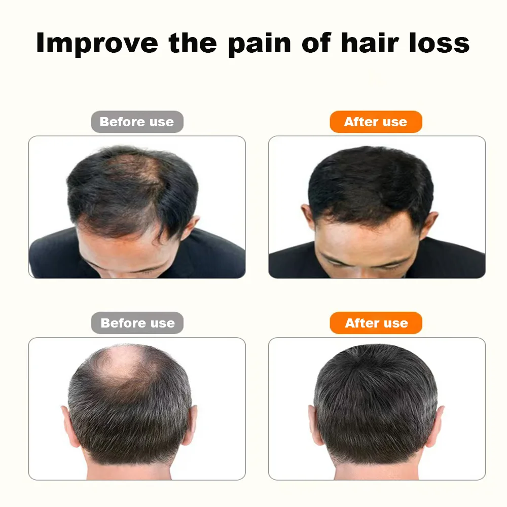 215 шт. шапочка для роста волос светодиодные устройства терапии красным светом