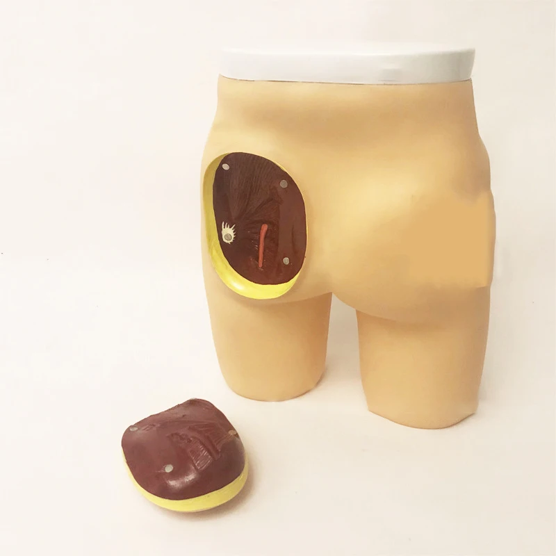 

Усовершенствованная модель глютеальной инъекции мышц и анатомической структуры