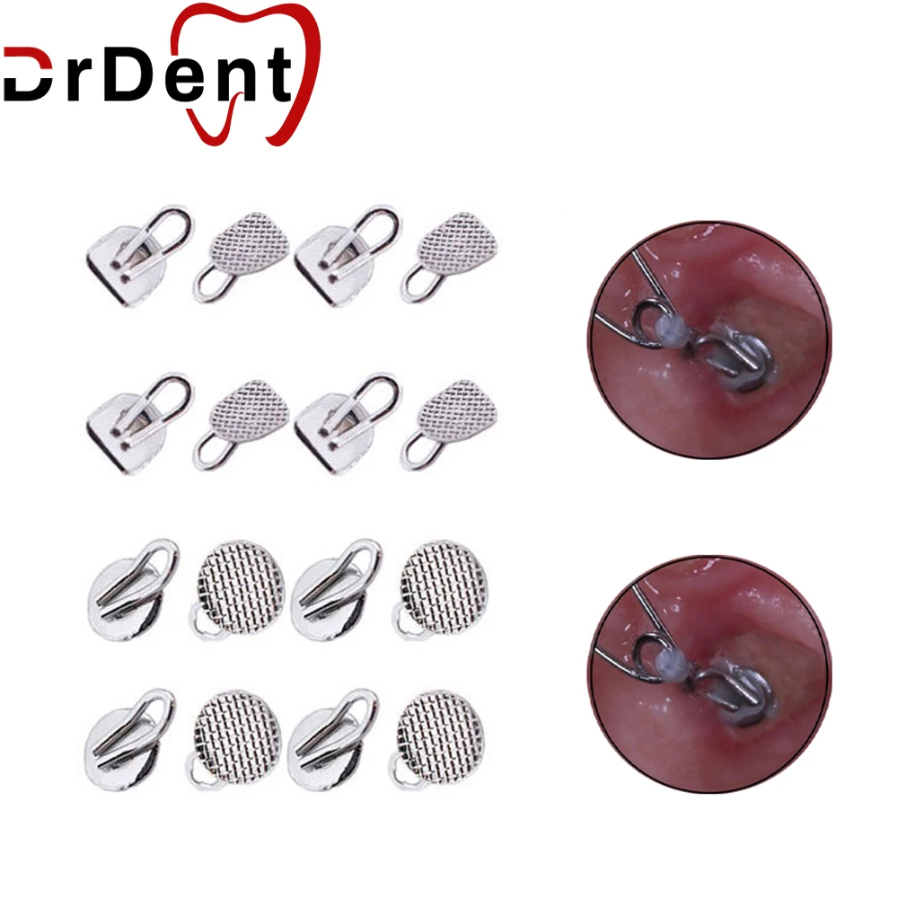 

50 шт./коробка, круглые и Прямоугольные зубные скобы