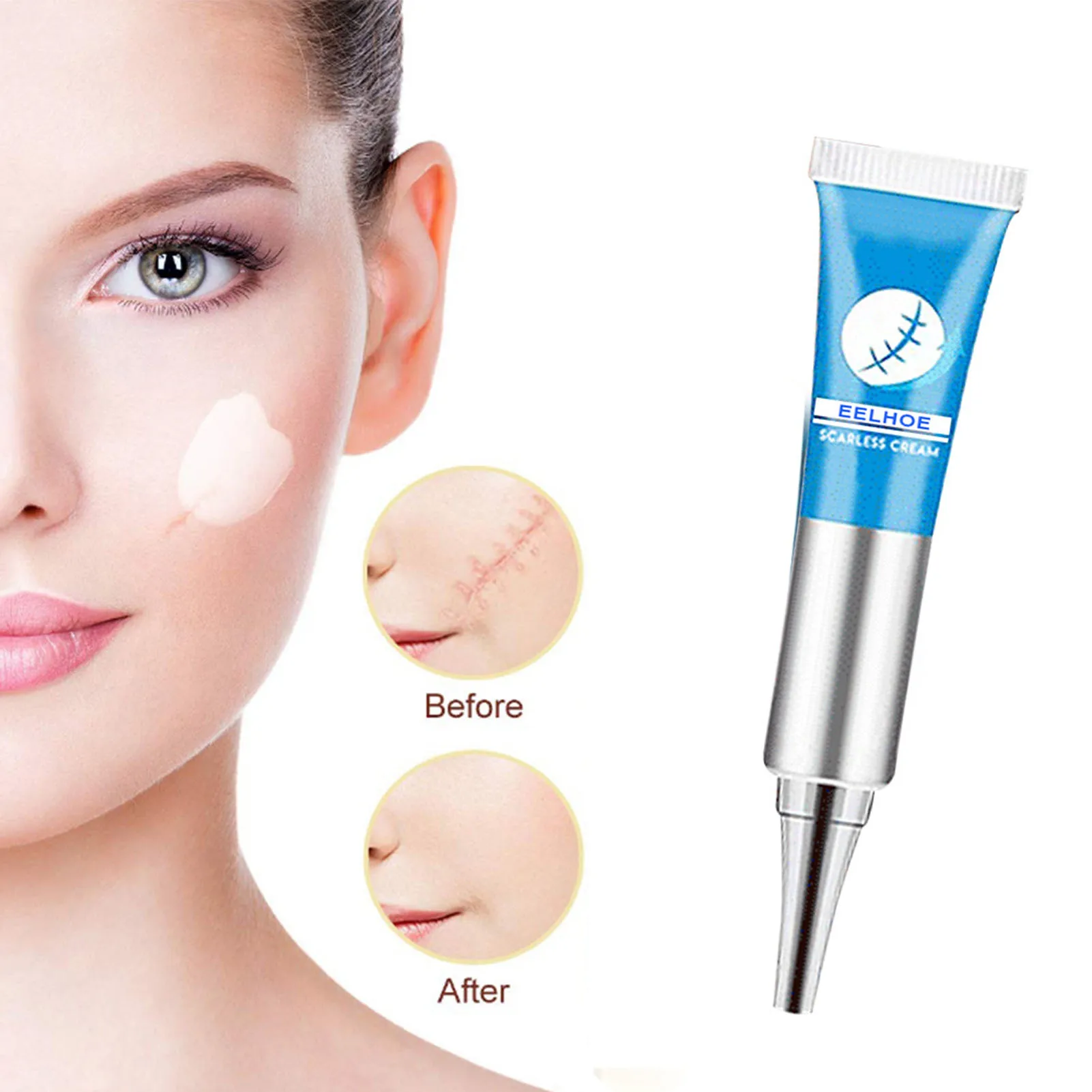 

Гель для удаления шрамов, крем для удаления шрамов, шрамов на лице, шрамов на теле, Удаления растяжек, гель для удаления следов на коже, восст...