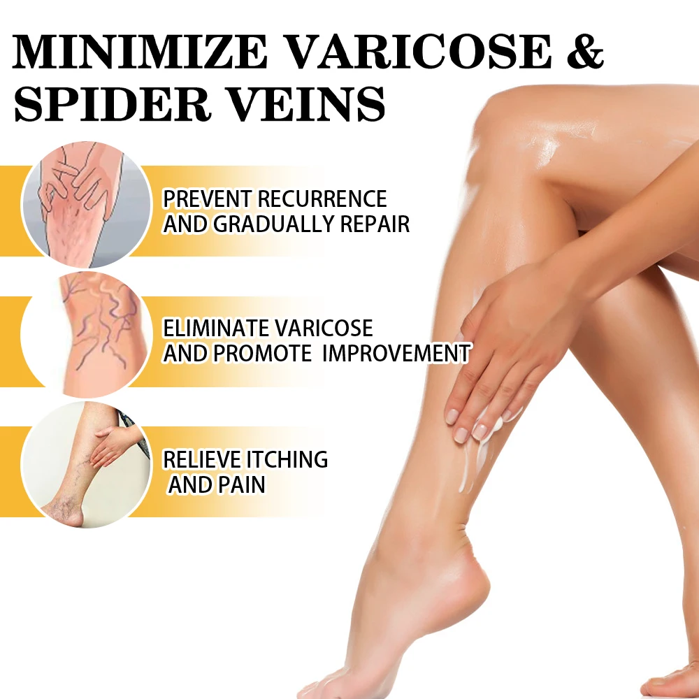 1/3/5/10 шт. Sumifun крем от варикозного расширения вен варикозный агирит мазь для