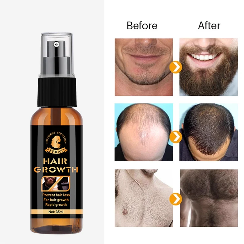 

Продукты для роста волос масло для роста бороды лечение против выпадения волос для женщин и мужчин натуральный капиллярный тоник для стимуляции роста