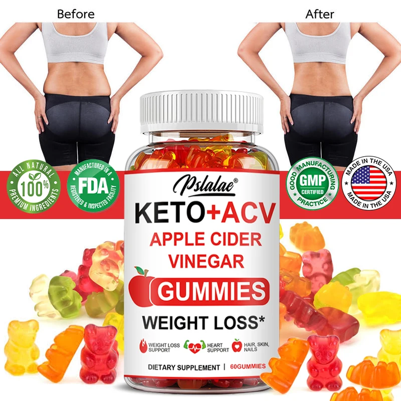 

Keto Acv Gummies - Weight Loss - Advanced Weight Management Weight Loss - Slim Keto Blast for Cleanse 60 Gummy Bears Non-GMO