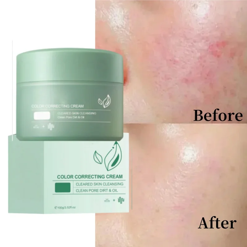 Увлажняющий крем для покраснения кожи лица улучшения чувствительной сухости