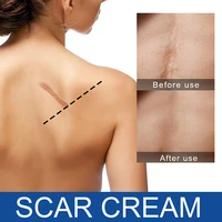 15g scar cream make scars smaller less visible skin care easy to apply scar treatment for both old and new scars
