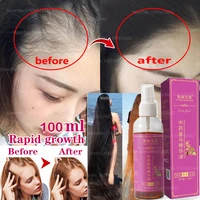 genuine anti fall and anti fall hair growth liquid to prevent bald hairline from growing quickly in private parts and long hair