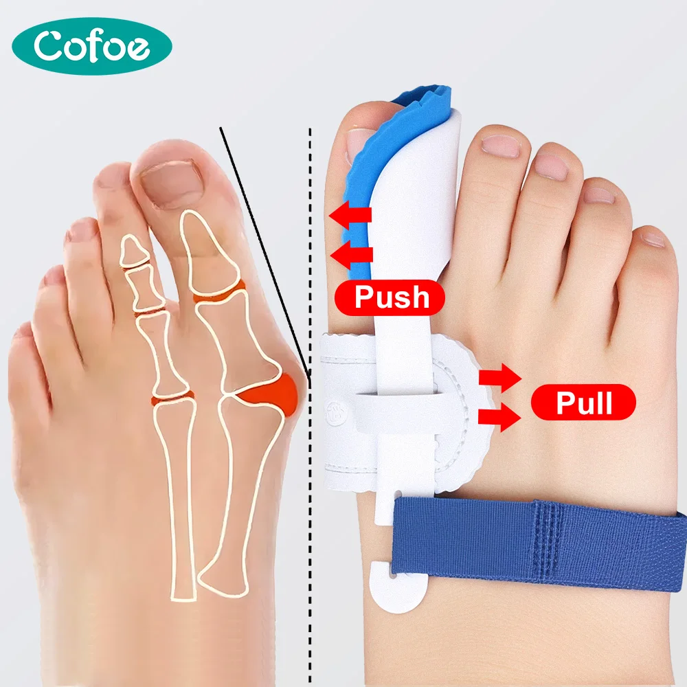 Ортопедические Профессиональные Инструменты Cofoe 1 Пара Ночной Ежедневный Уход