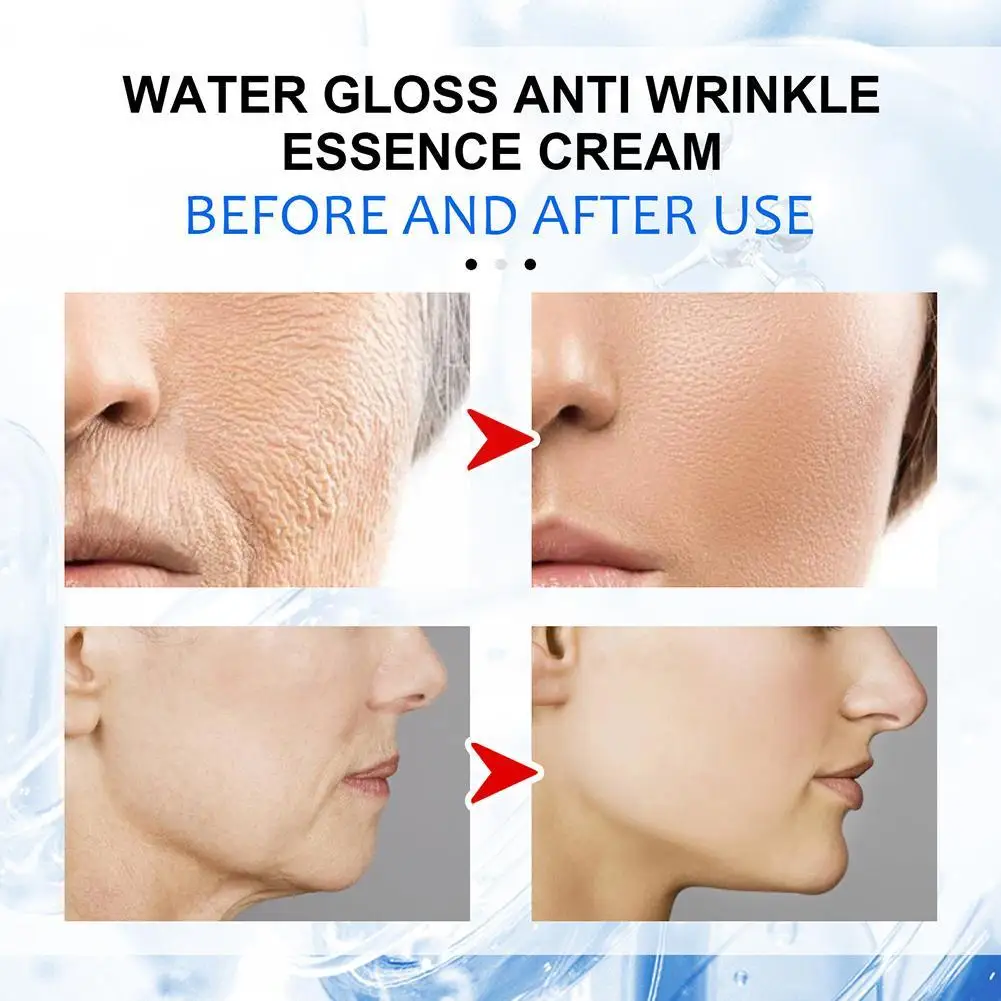 Рисунок 2 - Мгновенное удаление морщин крем