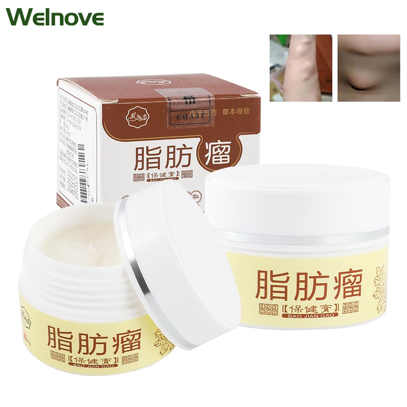 

30g/pc Lipoma Removal Ointment Antitumor Remove Fat Lump Cream Nodular Discomfort Skin Cyst Pain Relief Herbs Plaster Care