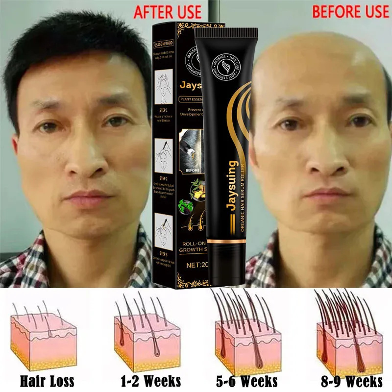 Hair Regrowth Serum Effective Anti-hair Loss Treatment Bald Frizz Sparse Nourish Scalp Massage Roller Hair Root Care Products