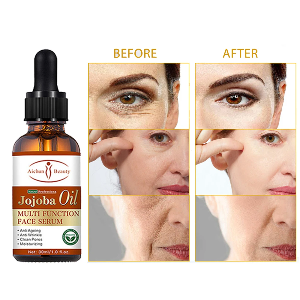

30ml Jojoba Oil Facial Serum Moisturizing Anti Wrinkle Aging Acnes Treatment Shrink Pores Facial Massage Oil Skin Care Serum