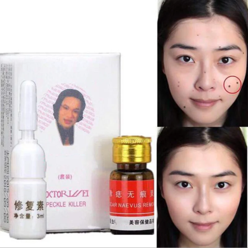 

Freckle Removal Mole Free Trace Water Wart Removal Skin Drip Remover Freckle Essence Facial Whitening
