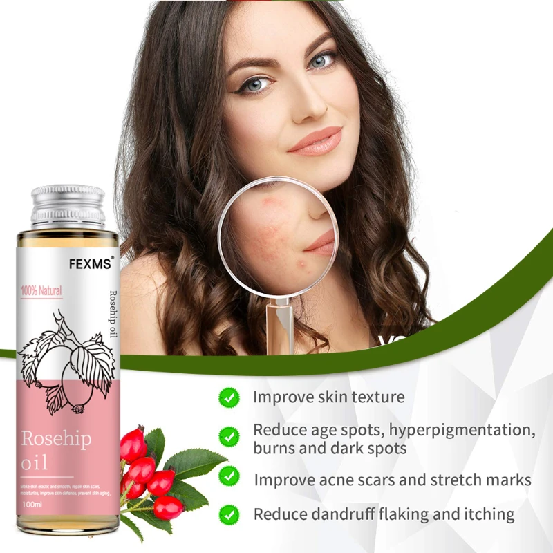 Rosehip seed oil 100% pure organic unrefined cold pressed anti-aging Rosehip hair skin and nails moisturizing free shipping 1pcs