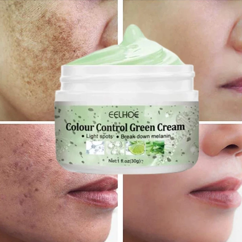 

Effective Whitening Freckles Cream Remove Melasma Dark Spot Lighten Acne Melanin Brighten Moisturizing Anti-aging Face Skin Care