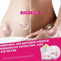 postpartucm obesity pr egnany massage cream stretch stretch marks remover soft skin remove stretch marks