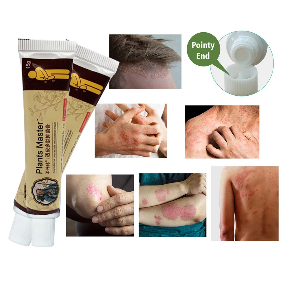 

Мазь при псориазе дерматите и экземе, крем для красоты и здоровья тела, восстанавливающая кожу, 15 г