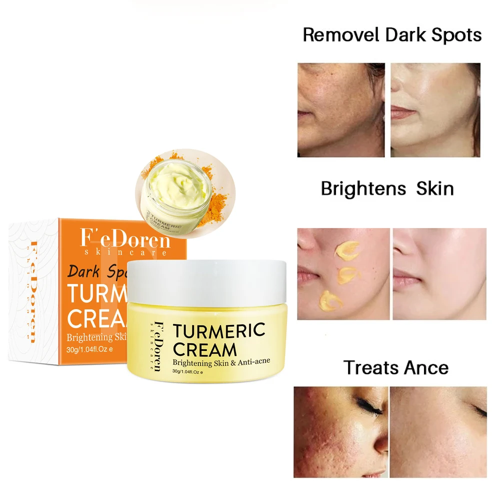 

Turmeric Face Cream Anti-aging Wrinkle Fade Freckles&Dark Spots Remove Lighten Skin Shrink Pore Anti-acne Facial Skin Care Cream