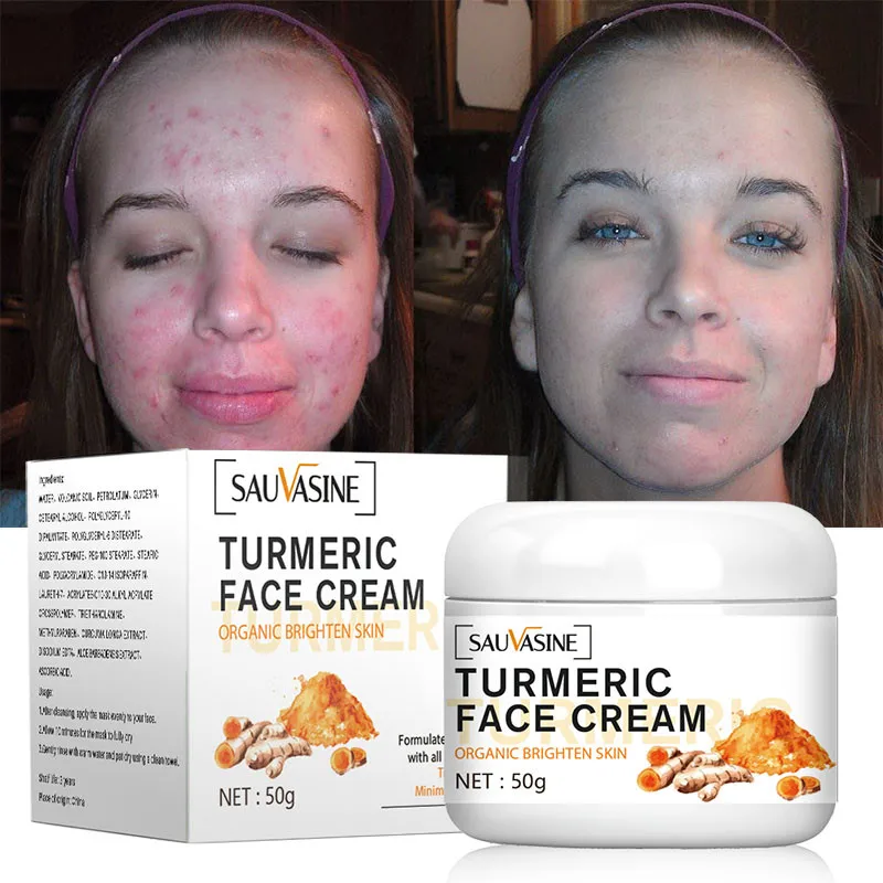Turmeric Face Whitening Brighten Cream Repair Acne Lighten Dark Spots Facial Serum Anti-Aging Fade Dark Skin Moisturizer Cream