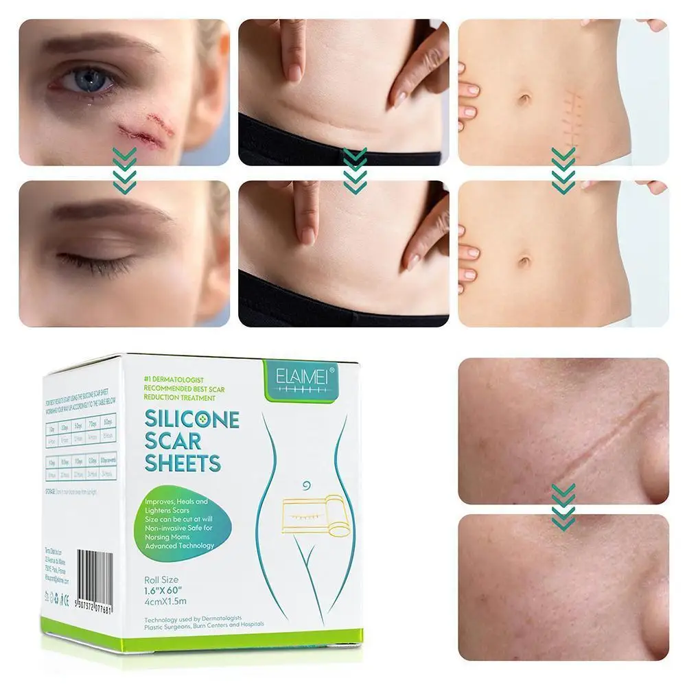 

Skin Tone Gel Scar Sticker Smooth Out Scars Patch Scar Scar Therapy Acne Sheet Removal Gel Treatment Silicone 4cm*150cm