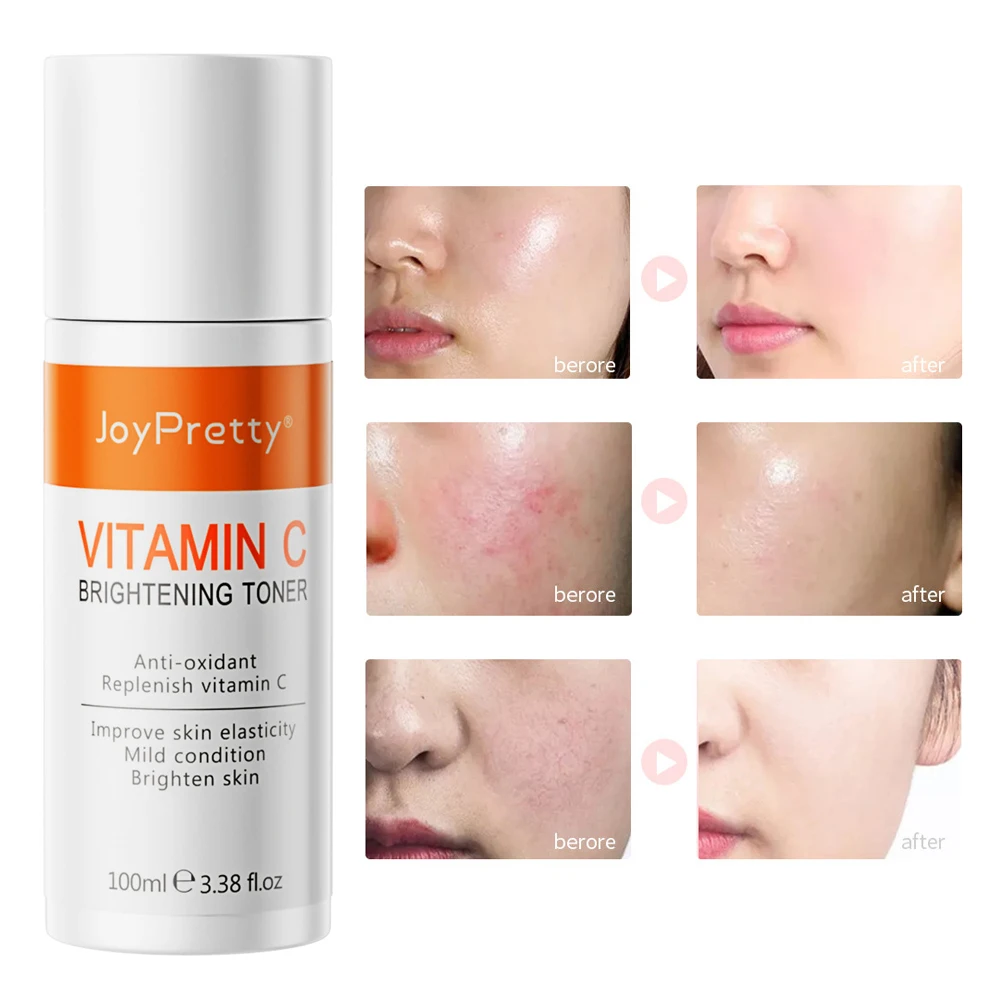 

Vitamin C Toner Brightening Facial Spray Moisturizing Face Serum Shrink Pores Oil Control Whitening Skincare essence water