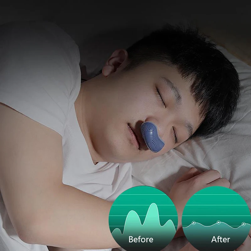

Electric Anti Snoring Prevention Electronic Device Sleep Stop Snore Aid Stopper