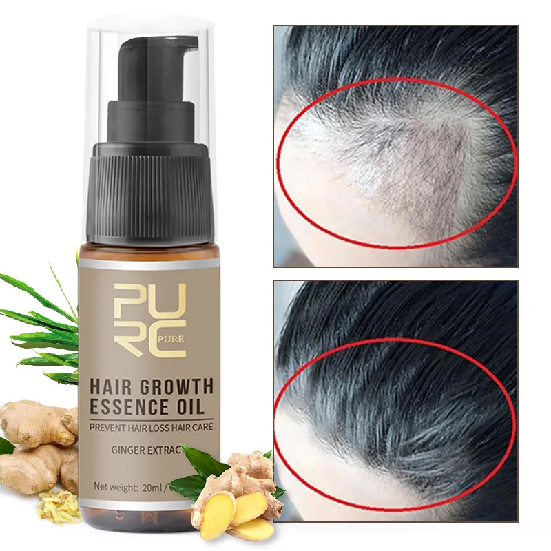 

20ml Hair Growth Essential Oil Fast Hair Growth Spray Anti Hair Loss Thinning Dry Scalp Care Beauty Hair Care Products PURC