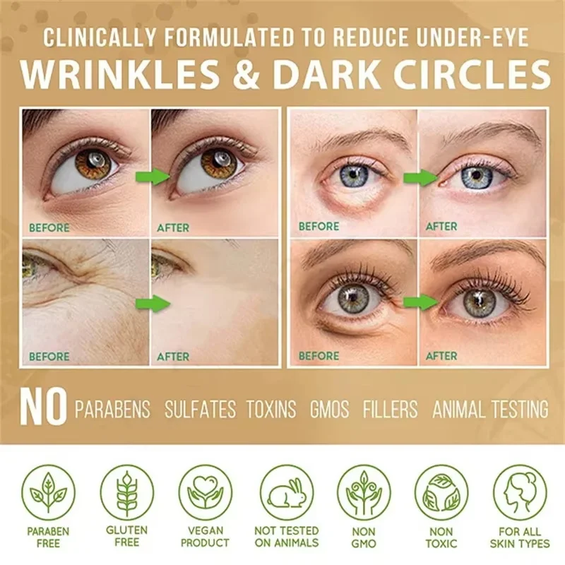 Гранулы жира на глазах удаление пятен укрепляющий крем против отечности