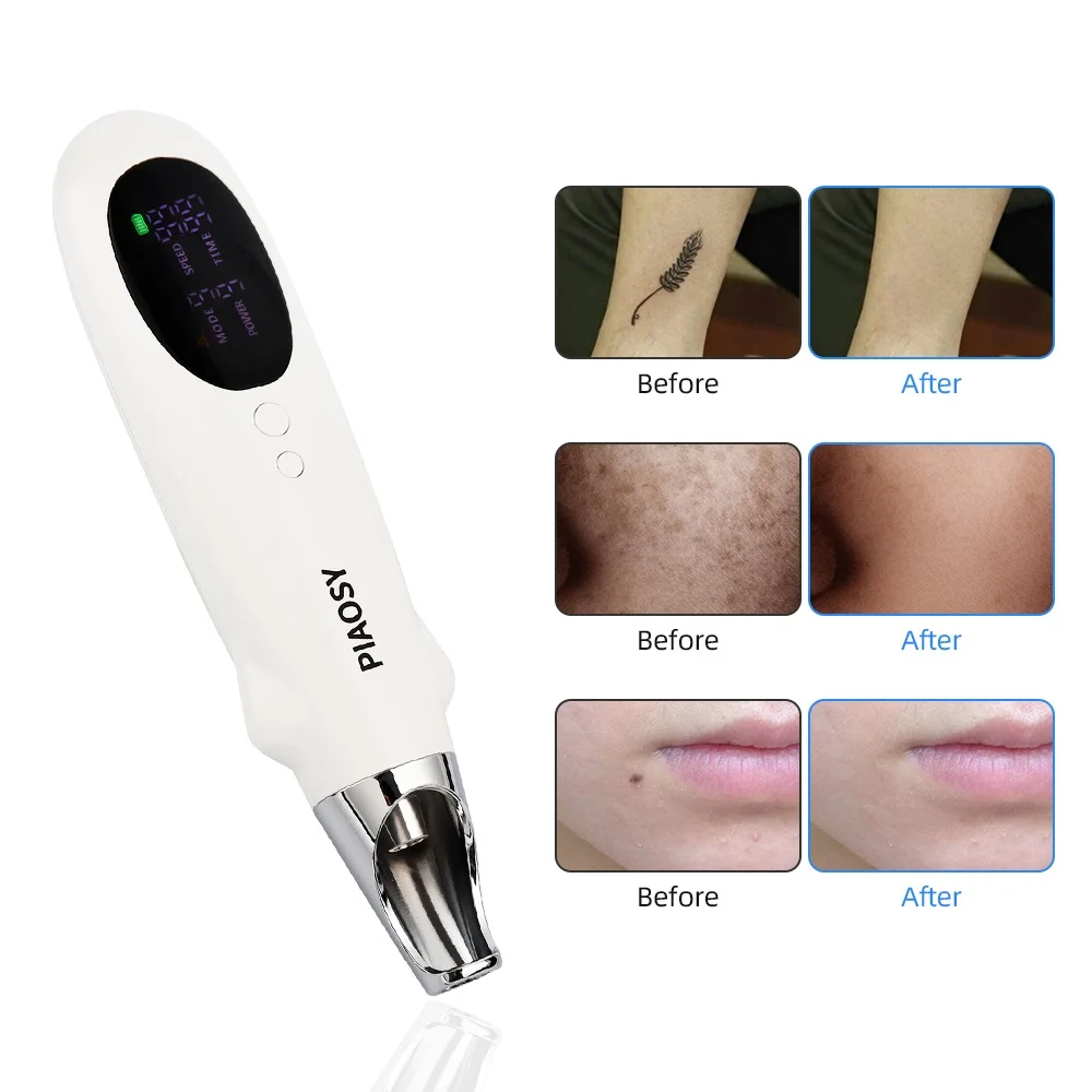 

9 + 9 Picosecond Laser Pointer, Upgraded Version,Tattoo, Wart, Freckle Removal, Eyebrow Wash, Rechargeable