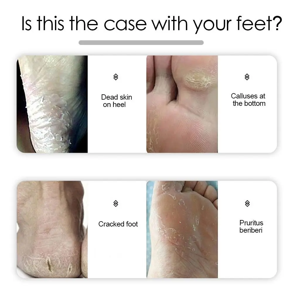 Инструмент для ухода за ногами из нержавеющей стали пилка педикюра средство