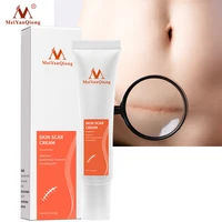 scar removal cream acne scars gel stretch marks surgical scar burn for body pigmentation corrector acne spots repair care 15g