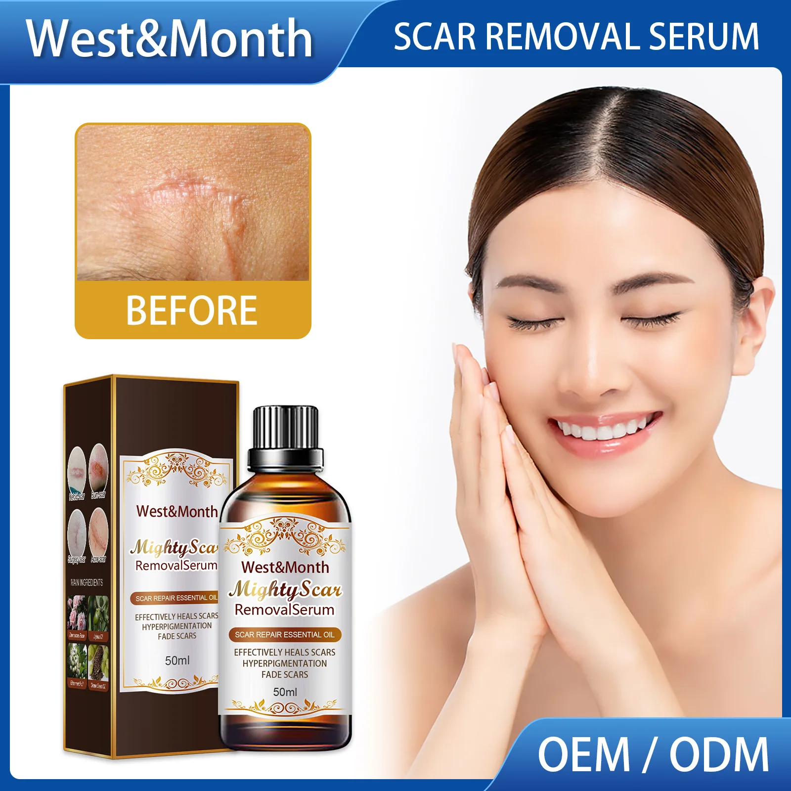 

Scar Repairing Essence Anti-BA Wound Repair Postoperative Concave and Convex Scar Scald Scar Light Removing Essence scar removal