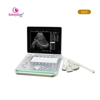 2020 portable color ultrasound scanner ultrasound ultrasonic phased array flaw detector portable ultrasonic diagnostic devices