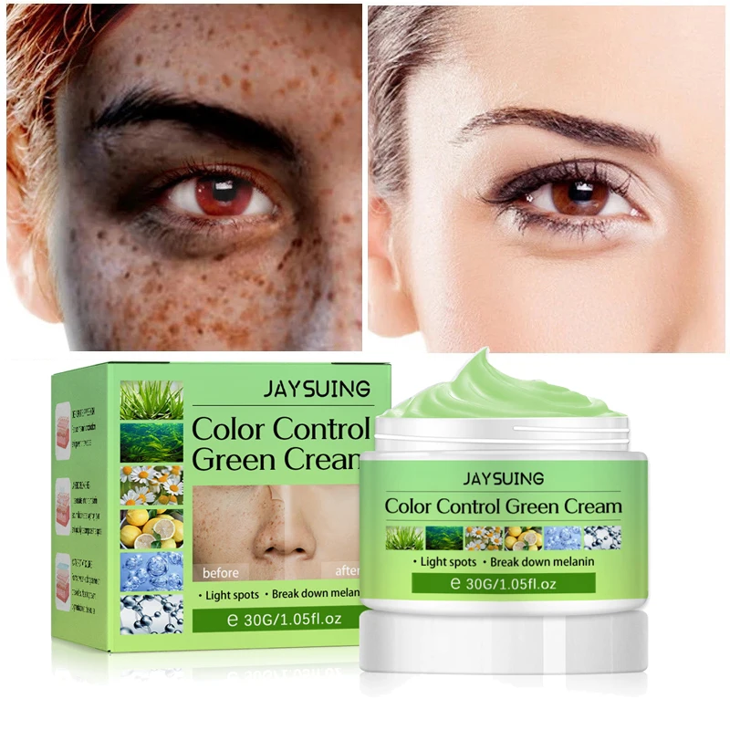

Niacinamide Whitening Freckles Cream Remove Melasma Dark Spot Melanin Fade Fine Lines Brighten Moisturizing Skin Care Products