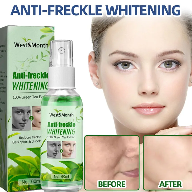 

Beauty skin Anti Freckles Whitening Remove Dark Spots Melasma Brighten Lighten Melanin Improve Dull face Serum Moisturize toner