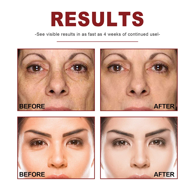 Антивозрастной крем для лица с улиткой коллагеновый укрепляющий против морщин