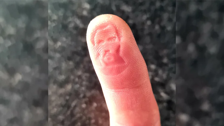 thumb