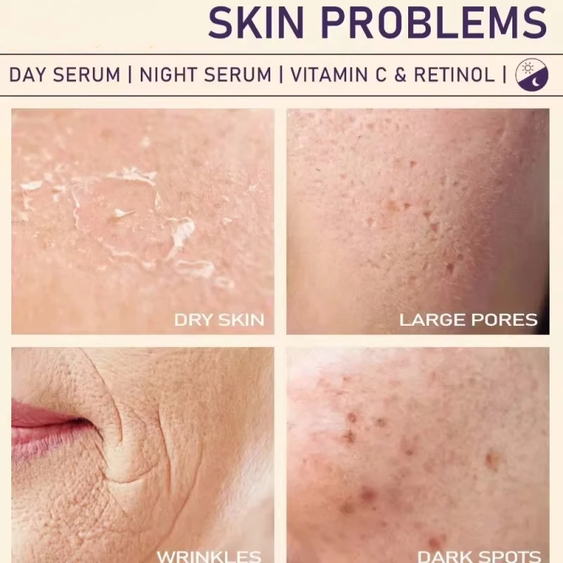 Коллагеновая эссенция для удаления морщин мгновенное укрепляющее лифтинговое