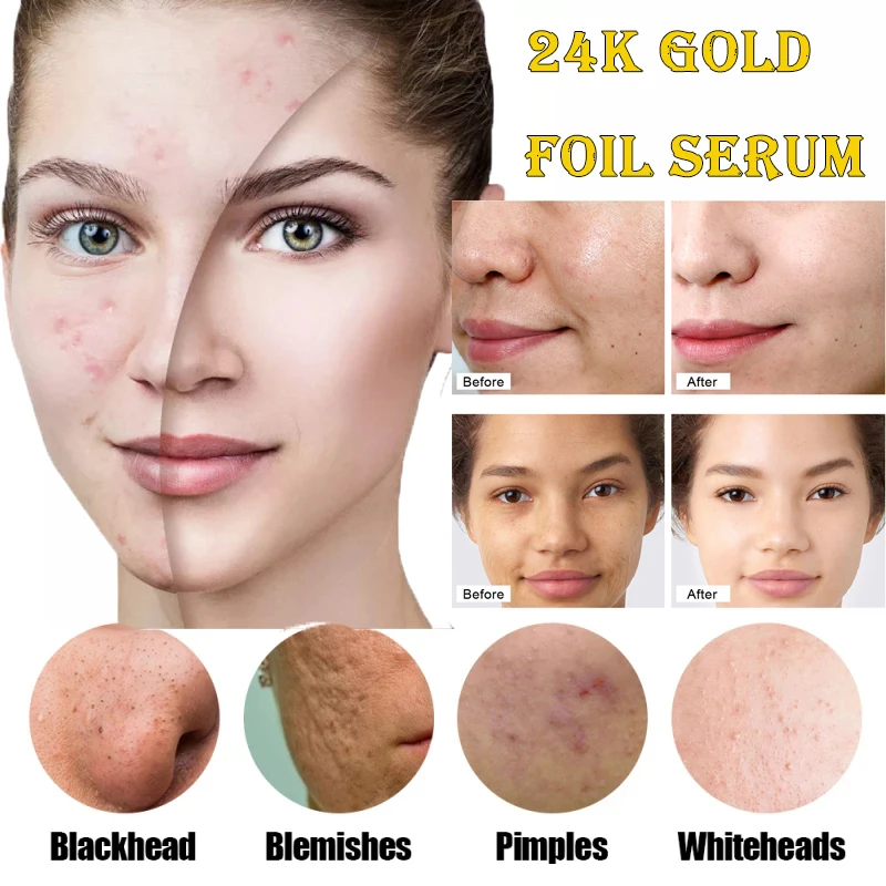 

24K Gold Hyaluronic Acid Nicotinamide Face Serum Replenishment Moisturize Shrink Pore Brighten Skin Care Firming Facial Essence