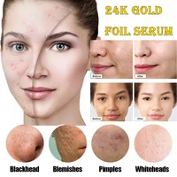 24k gold hyaluronic acid nicotinamide face serum replenishment moisturize shrink pore brighten skin care firming facial essence