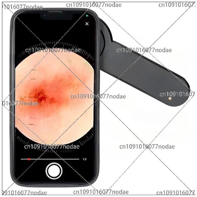 Одобренный CE медицинский дермоскоп DE-3100 для дерматологии иридологии