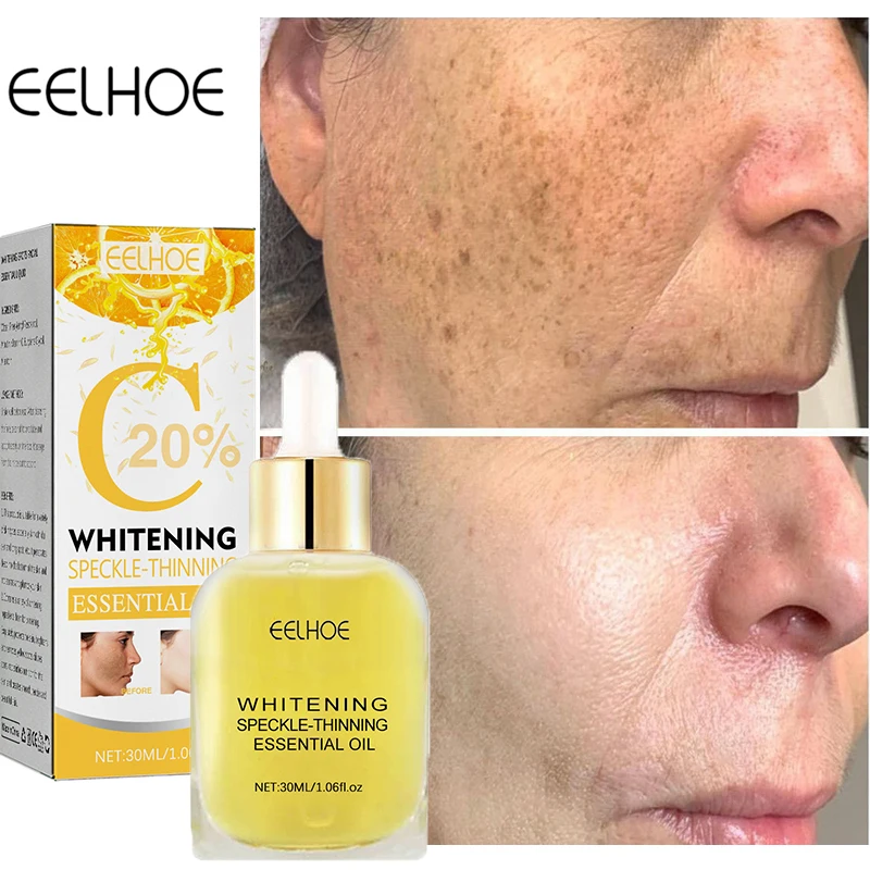 Vitamin C Whitening Face Serum Anti-Freckle Fade Dark Spots Removal Melasma Melanin Brightening Moisturizing Skin Care Products