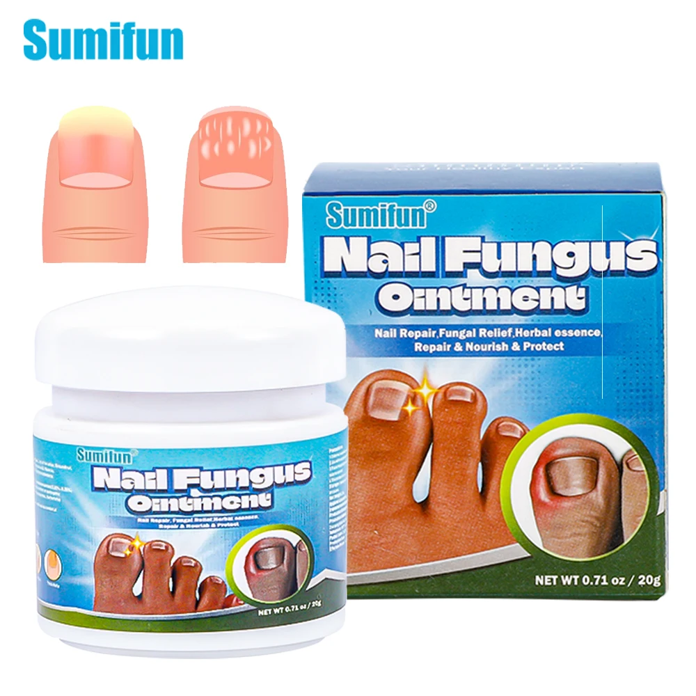 

20G Nail Fungus Treatment Cream Paronychia Onychomycosis Repair Antibacterial Herbal Ointment Anti Infection Foot Care Tools