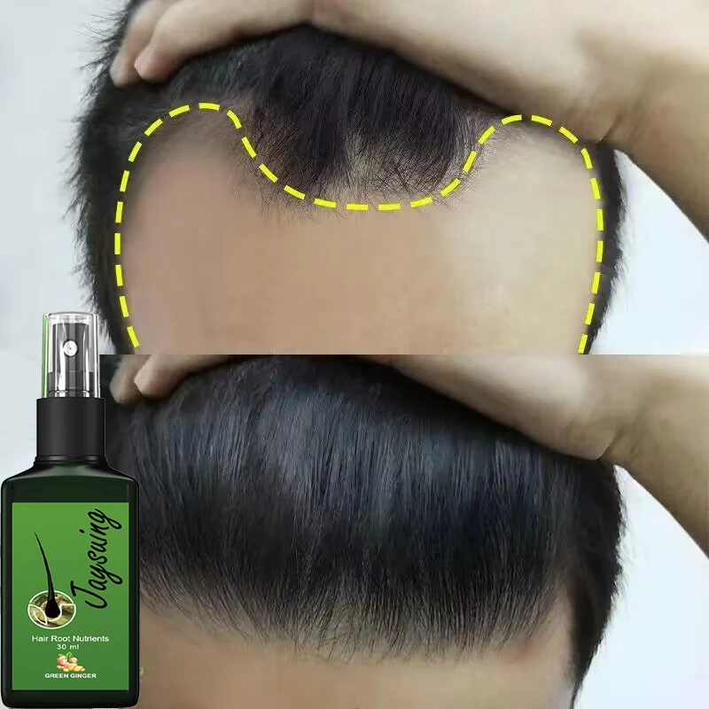 

Ginger Hair Growth Spray Fast Grow Anti Hair Loss Essence Liquid Scalp Damaged Treatment Repair Nourishing Beauty Care Products