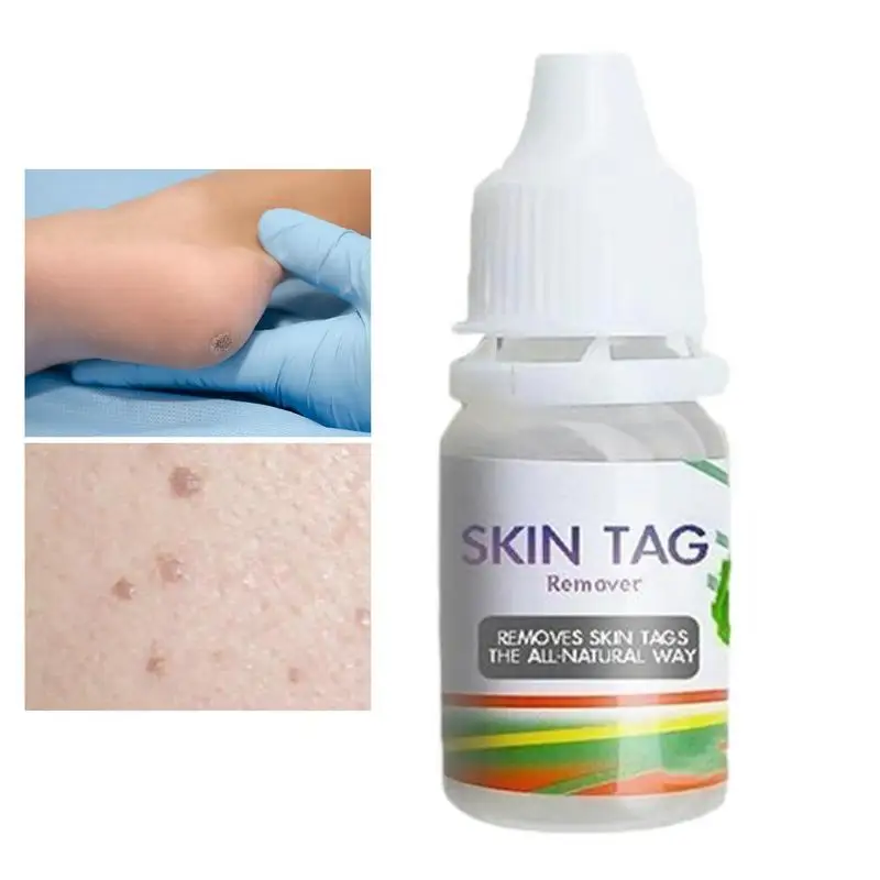 

Liquid Skin Tag Remover Corn Plaster Wart Solution Non-Irritating Removes Skin Tags Plantar Warts Skin Tags Corns