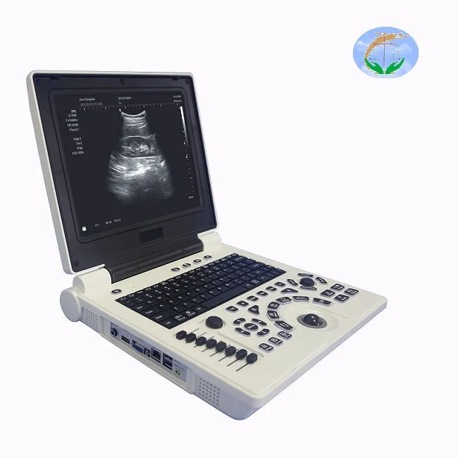 

Ultrasound Scanner P20 Notebook Ultrasonic Diagnostic System Buy Machine