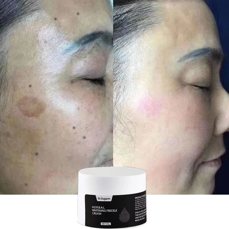 Dr.Sugarm Whitening Face Cream Repair Fade Freckles Remove Dark Spots Melanin Remover Brightening Free Shipping