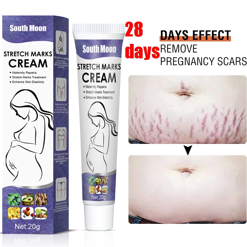 Maternity Stretch Marks Removal Cream Body Buttock Breast Mark Skin Care Effective Anti White Stretch Scar Remover Cream