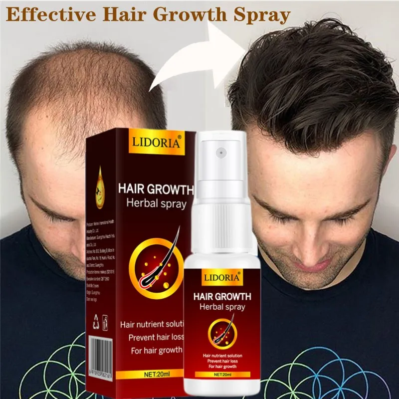 Instant Hair Growth Spray Fast Hair Growth Serum Anti Hair Loss Essential Oil Hair Thinning Treatment Beauty Health Hair Care