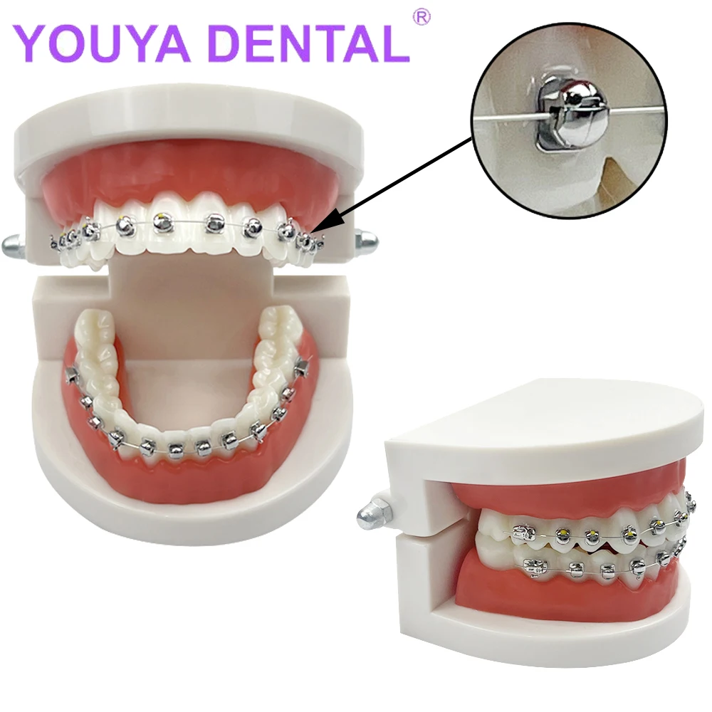 1 шт. стоматологическая ортодонтическая модель зубов с металлическими брекетами
