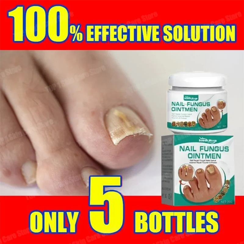 Антиинфекционный онихомикоз лечение грибка ногтей сыворотка для восстановления